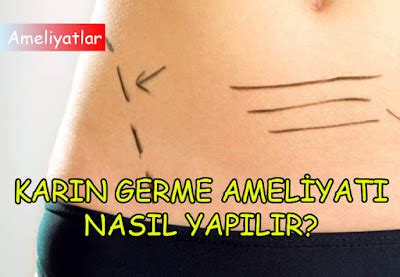 Karın Germe: Sonuçlar ve Beklentiler